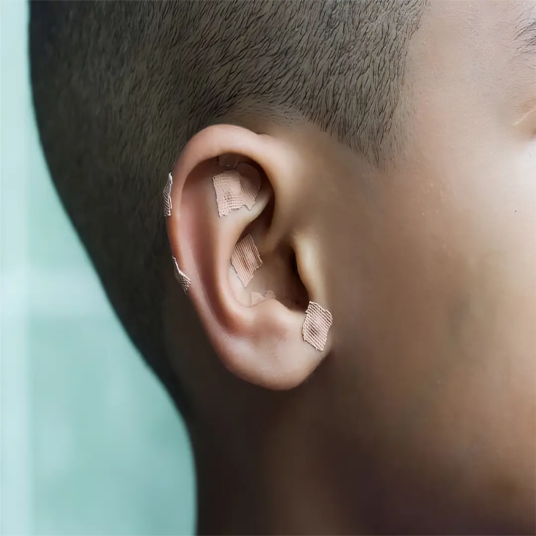 NeuroMe™ Ear Seeds